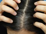 Hair tips: నెయ్యితో ఇలా చేస్తే జుట్టు నల్లబడుతుంది.. మీరూ ట్రై చేయండి 