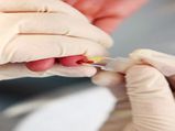 Rare blood group: అత్యంత అరుదైన రక్త గ్రూపు.. భారత్ లో ఇదే మొదటిది 