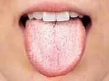 Oral Health: మీ నోరు ఇలా ఉంది అంటే.. మీ శరీరంలో ఏదో పెద్ద సమస్య ఉందని అర్థం.. జాగ్రత్త...!!