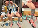 Messi And Red Ribbon: మెస్సీ కాలికి రెడ్ రిబ్బన్.. దాని వెనక ఉన్న కథెంటో తెలుసా? 