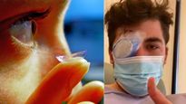 Parasite Eat Eye: కాంటాక్ట్ లెన్స్‌తో నిద్రపోతే.. కంటినే తిన్న పరాన్నజీవి