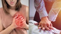 How To Do CPR: సీపీఆర్ అంటే ఏంటి? గుండెపోటుకు గురైన వ్యక్తికి CPR చేస్తే ఉపయోగం ఉంటుందా?
