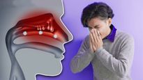 H1N1 Influenza:అప్పర్ రెస్పిరేటరీ ఇన్ఫెక్షన్: ముక్క, గొంతు, శ్వాసకోశ ఇన్ఫెక్షన్ అంటే ఏమి, ఎలా వస్తుంది, నివారణ
