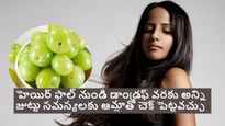 హెయిర్ ఫాల్ నుండి డాండ్రఫ్ వరకూ.. అన్ని సమస్యలకు ఉసిరికాయతో ఇలా చెక్ పెట్టవచ్చు..!  మీకు కూడా ఈ సమస్య   ఉందా.?