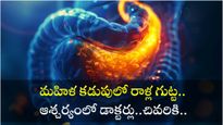  షాకింగ్ :  మహిళ కడుపులోంచి ఒకటి కాదు రెండు కాదు ఏకంగా 570 రాళ్లను తొలగించిన డాక్టర్లు..