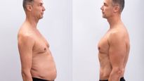 WEIGHT LOSS TIPS IN TELUGU: పొట్ట కొవ్వుతో ఇబ్బంది పడుతున్నారా?.. ఈ టిప్స్‌తో సులువుగా కరిగించుకోవచ్చు!