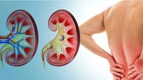 Good Habits For Kidney Health: కిడ్నీలను ఆరోగ్యంగా ఉంచే 5 అలవాట్లు ఇవే..పొరపాటున మిస్ చేస్తే అంతే