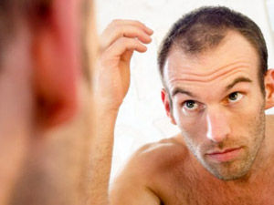 Natural Ways to Reduce Hair Loss Natural Ways to Reduce Hair Loss