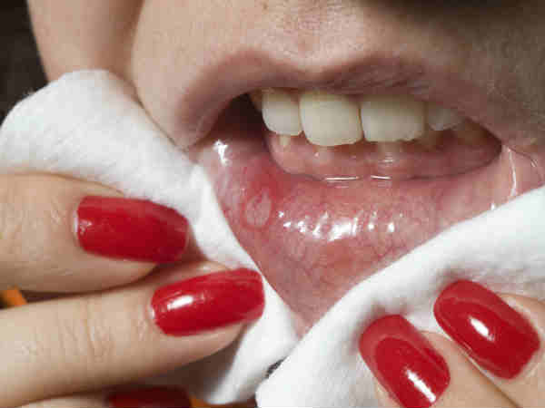 ఇవి హెచ్ఐవి(HIV) పాజిటివ్ లక్షణాలు...!?