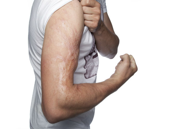 చర్మ - జుట్టు సమస్యలకు పరిష్కారం కర్పూరం..!