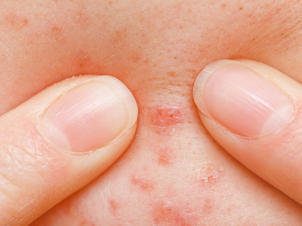 బాడీ వ్యాక్సింత్ వల్ల దుష్ప్రభావాలు