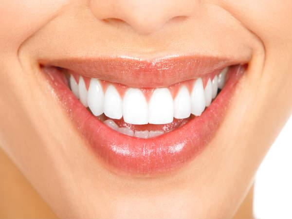 పళ్ళు తెల్లబర్చుకోవడం కోసం చికిత్స
