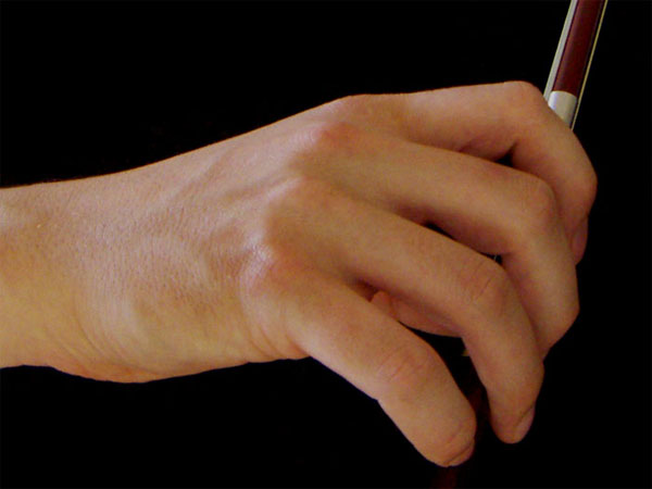 చేతుల మీద పుట్టు మచ్చలుంటే: