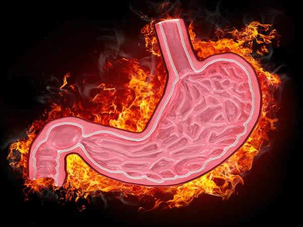 5. కోలన్ క్యాన్సర్