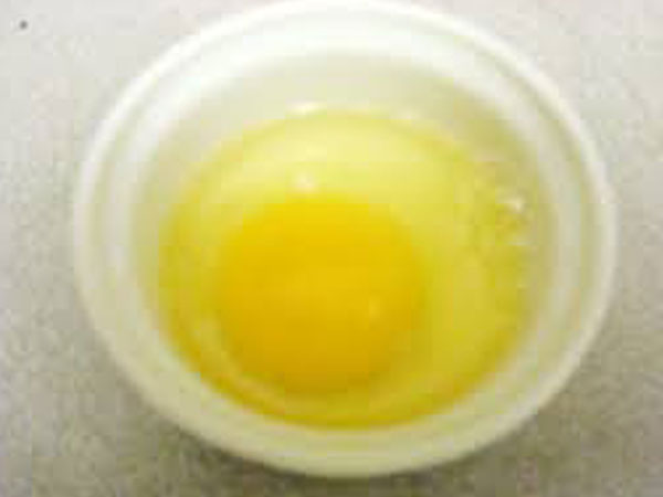 తెల్ల సొన