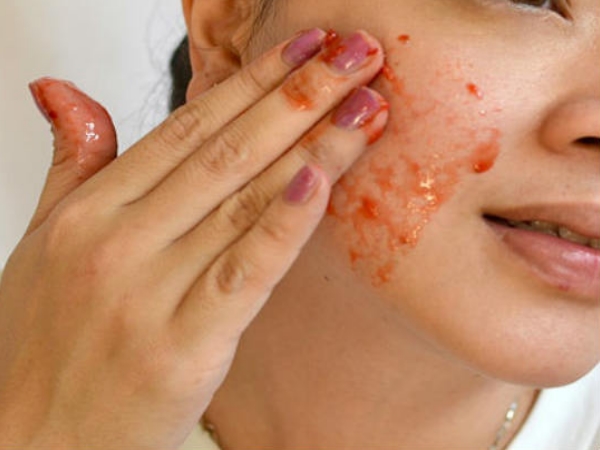  స్క్రబ్బింగ్: 