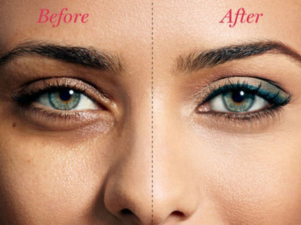  డార్క్ సర్కిల్స్ ను తగ్గిస్తుంది: