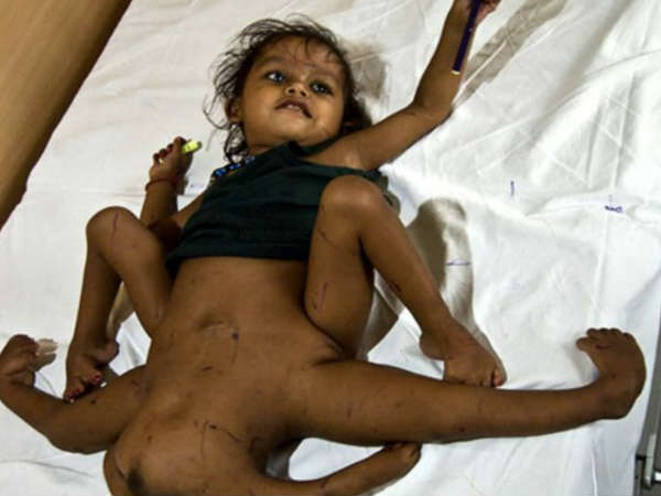 రకరకాల అవయవాలు