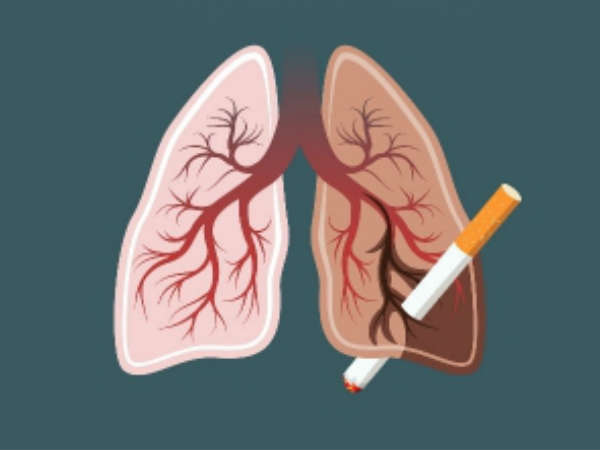 లంగ్ క్యాన్సర్: