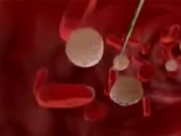 జికా వైరస్ గురించి తెలుసుకోవాల్సిన విషయాలు