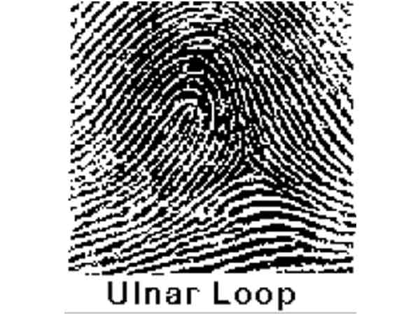 ఉల్నార్ లూప్స్