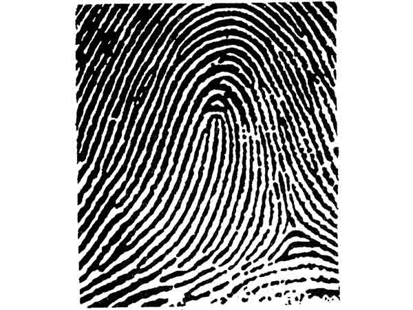 రేడియల్ లూప్స్