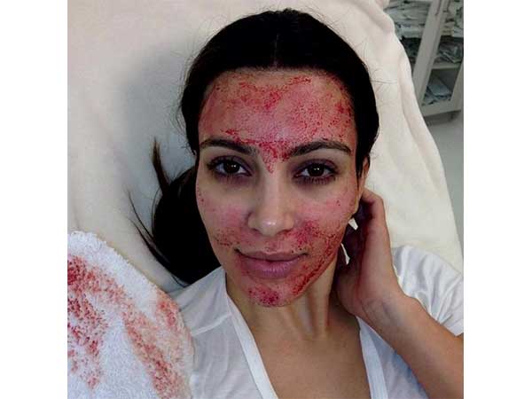 పిశాచాల ఫేస్ లిఫ్ట్