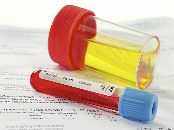 Surprising Signs Of Liver Damage That We Did Not Know