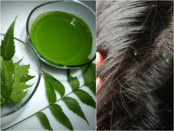 10. స్కాల్ప్ ఇన్ఫెక్షన్స్ ను నివారిస్తుంది: 