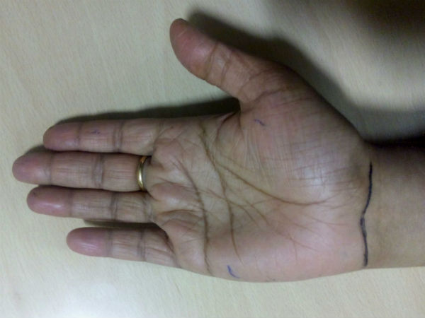 మొదటి బ్రాస్లెట్ లైన్ చెయిన్ రూపంలో ఉంటే :