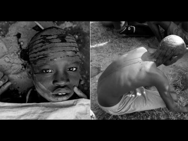 ఫేసియల్ స్కేరిఫికేషన్