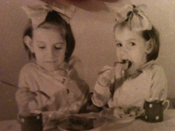 శరీరాలు అతికివున్న కవలలు జన్మించినప్పుడు ఆ పిల్లలు మరణించారని,