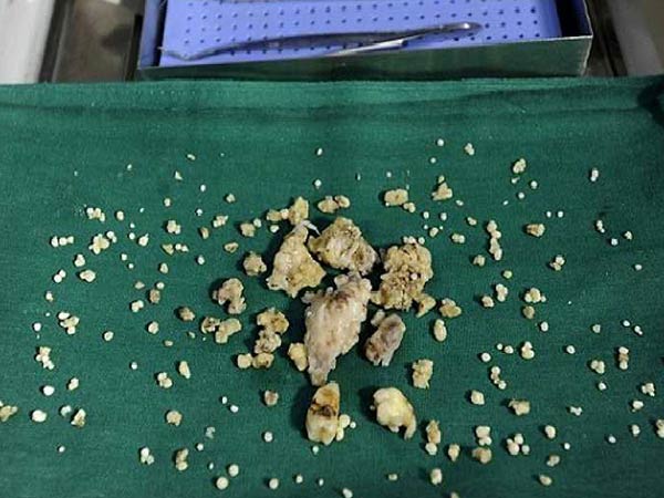 అతను అదృష్టవంతుడు...