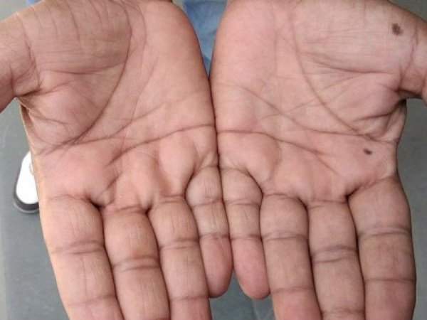 #5.ఏ వ్యక్తికైతే వారి చిన్న వేలు నుండి మధ్యలో వేలు వరకు ఒక లైన్ కలిగి ఉంటుందో 