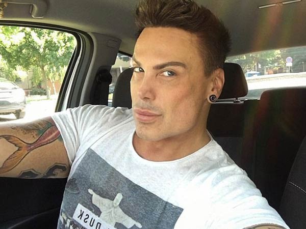 అతను ప్రియాపిజం (priapism) అని పిలువబడే ఒక పరిస్థితిని గురయ్యాడు.