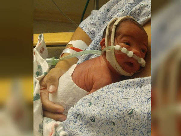 This birth story is different when compared to others