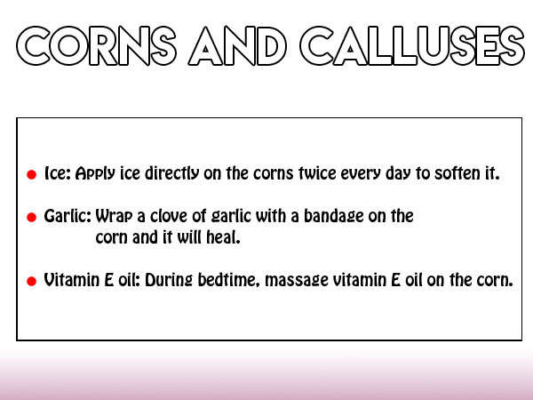 కార్న్స్ మరియు కాళ్ళుసెస్