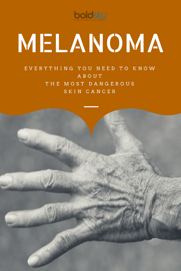 The Complete Guide to Melanoma: Symptoms