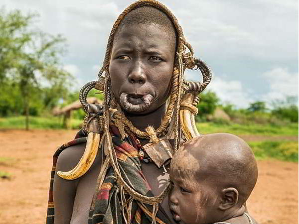 6. మహిళలు తమ పెదాల దగ్గర వున్న పళ్ళను తొలగిస్తే