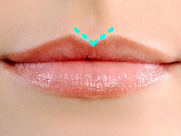 పై పెదవి చాలా పదునుగా ఉన్నట్లయితే :