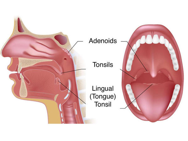 7. అడినాయిడ్స్ 7. అడినాయిడ్స్