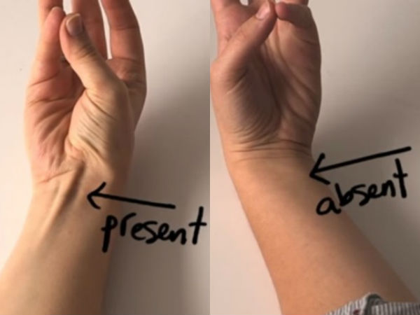 10. పల్మరిస్ మజిల్ 10. పల్మరిస్ మజిల్