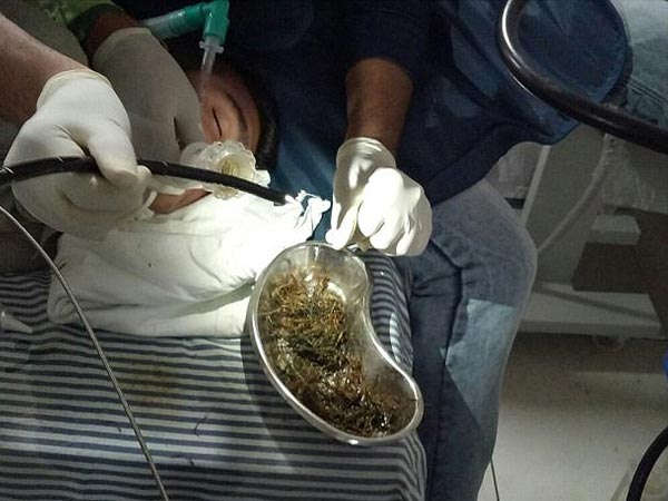 అతనికి ఇంకా సర్జరీలు అవసరం