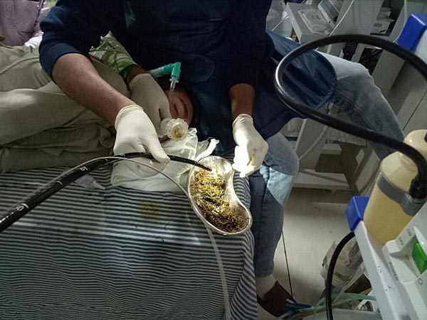 అతనికి వెంటనే ఆపరేషన్ చేసారు