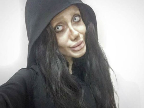 50 సర్జరీలు చేయించుకుంది