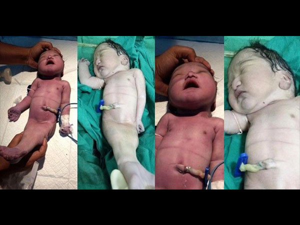 రెండో కేసు