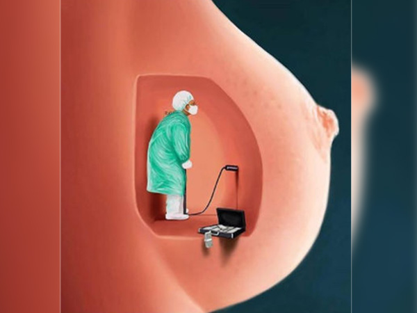 వక్షోజాలను పెంచుకోవడం