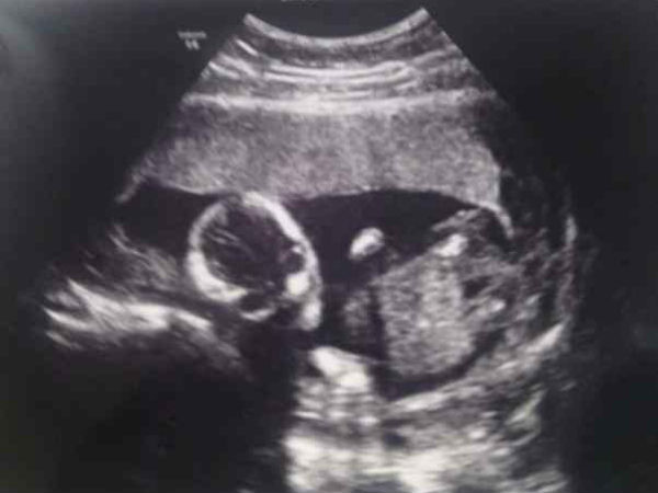 చిత్రం #2 అది ఇక్కడ కనిపిస్తుందా?