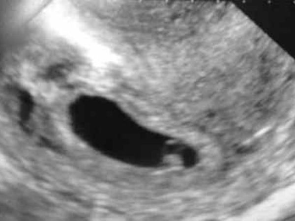 చిత్రం #6 బిడ్డ ఎక్కడ ఉంది?