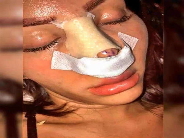 మొదట చిన్న సర్జరీలు